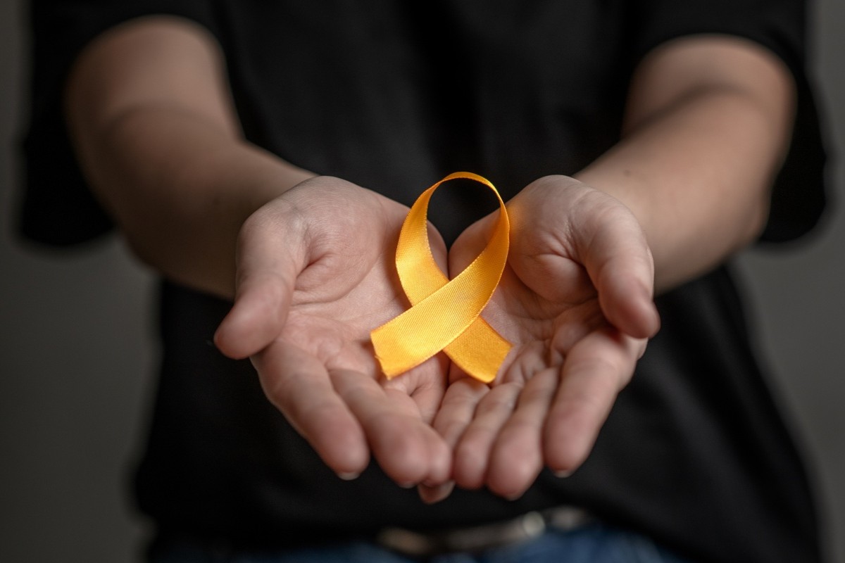 Close up female hands hold yellow ribbon. Concept of suicide problems and their prevention. 