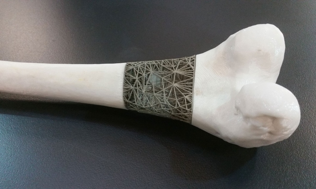 Một mẫu cấy ghép xương in 3D. 